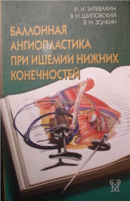 Затевахин И.И., Шиповский В.Н., Золкин В.Н. Баллонная ангиопластика при ишемии нижних конечностей