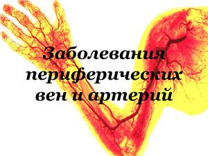 Заболевания периферических сосудов
