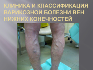 Клиника и классификация варикозной болезни вен нижних конечностей