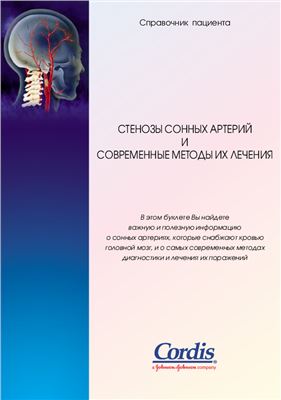 Стенозы сонных артерий и современные методы их лечения
