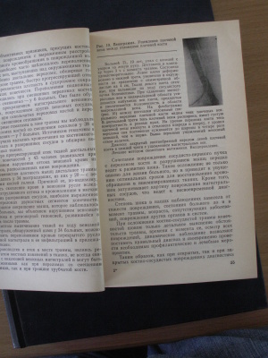 Бабоша В.А., Костин Н.С. Повреждения магистральных сосудов при переломах и вывихах костей конечностей